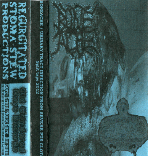 Urinary Tract Infection From Severe Pus Clots : Split Tape 2012